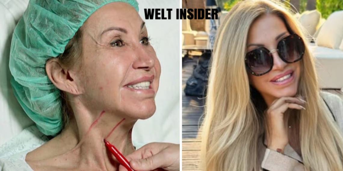 carmen geiss facelift
