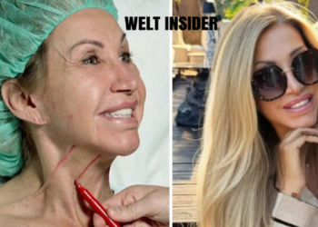 carmen geiss facelift